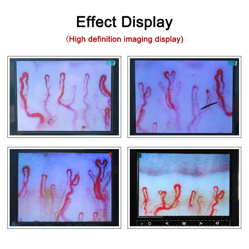 Professional medical aesthetic equipment: Nail fold capillary microcirculation XW880 all-in-one machine with color LCD display