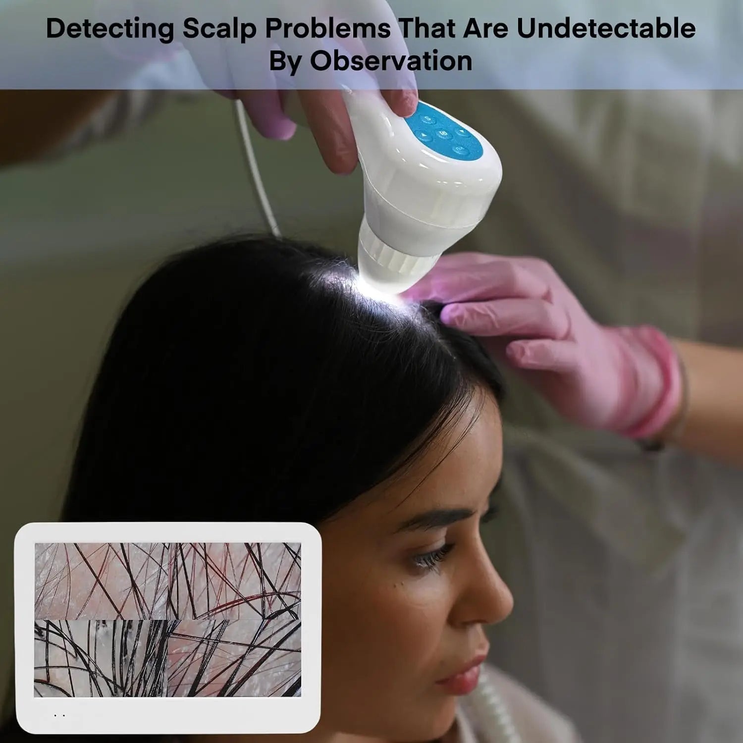 12" Scalp Analysis Machine Skin Tester Diagnosis Digital Analyzer Hair Detector Microscope Hair Follicle Health Detection Camera