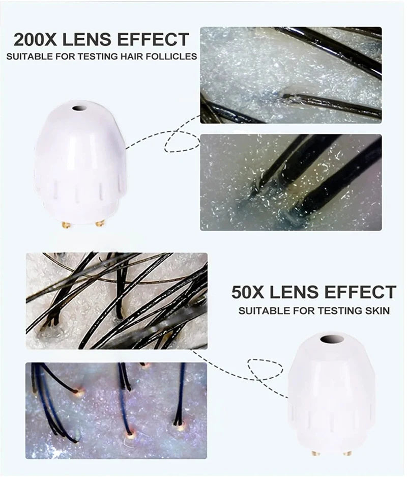 Scalp Hair Follicle Analyzer Skin Detector 15 Inch High-Definition Large Screen 50x And 200x Magnification For Skin Diagnosis