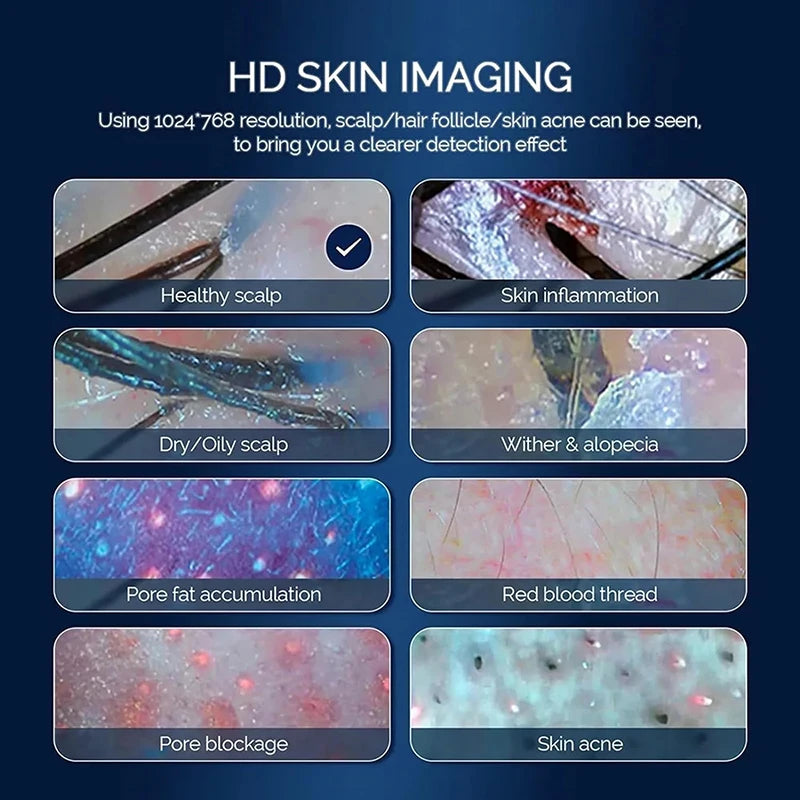 Scalp Hair Follicle Analyzer Skin Detector 15 Inch High-Definition Large Screen 50x And 200x Magnification For Skin Diagnosis