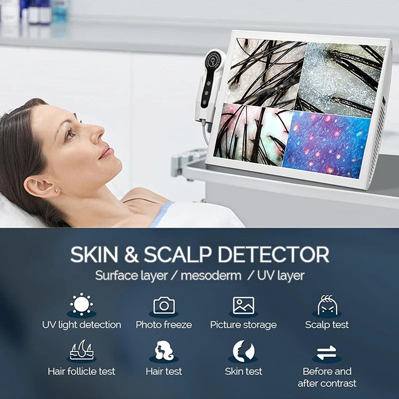 Scalp Hair Follicle Analyzer Skin Detector 15 Inch High-Definition Large Screen 50x And 200x Magnification For Skin Diagnosis