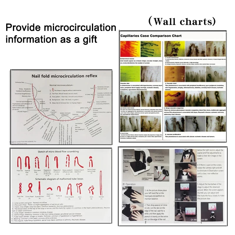 Professional medical aesthetic equipment: Nail fold capillary microcirculation XW880 all-in-one machine with color LCD display